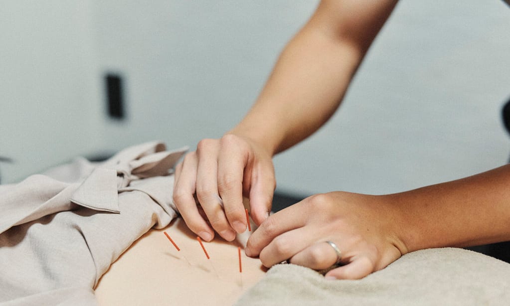 女性従業員の腰部に院長が鍼治療している写真