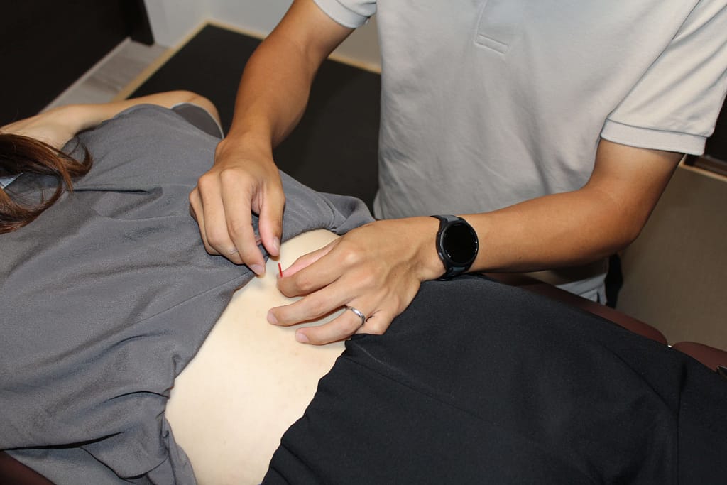 女性従業員の腰部に院長が鍼灸を行っている写真
